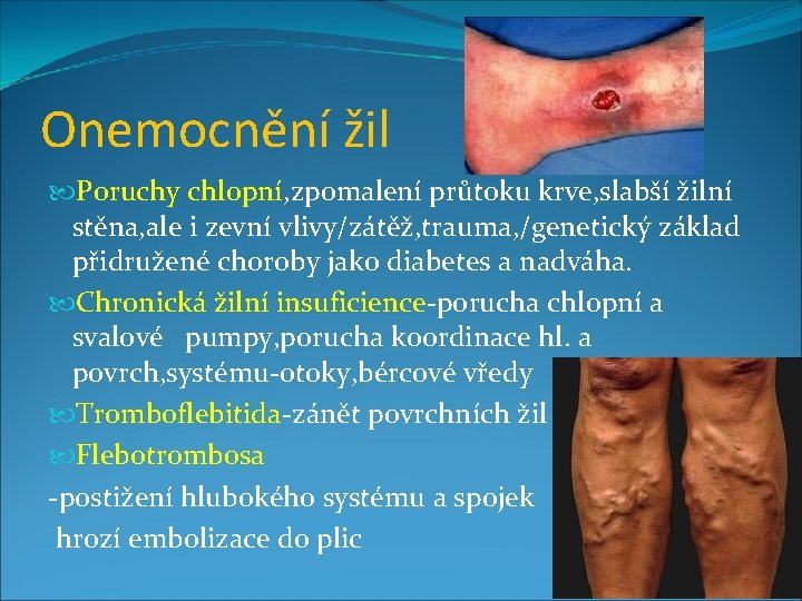 Onemocnění žil Poruchy chlopní, zpomalení průtoku krve, slabší žilní stěna, ale i zevní vlivy/zátěž,