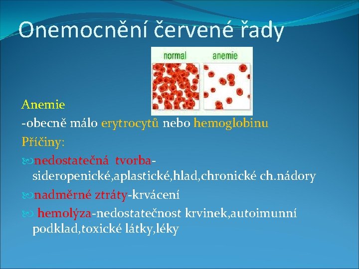 Onemocnění červené řady Anemie -obecně málo erytrocytů nebo hemoglobinu Příčiny: nedostatečná tvorbasideropenické, aplastické, hlad,