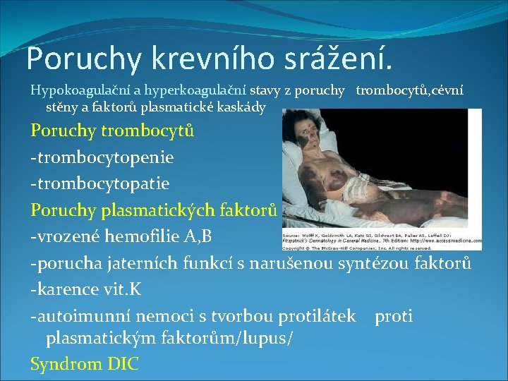 Poruchy krevního srážení. Hypokoagulační a hyperkoagulační stavy z poruchy trombocytů, cévní stěny a faktorů