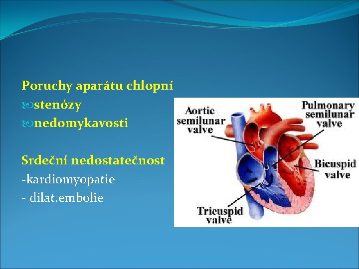 Poruchy aparátu chlopní stenózy nedomykavosti Srdeční nedostatečnost -kardiomyopatie - dilat. embolie 