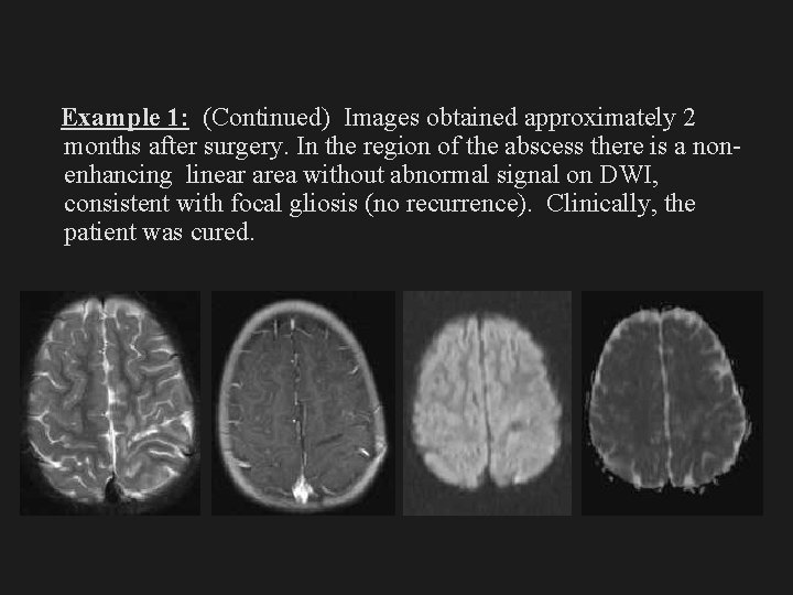 Example 1: (Continued) Images obtained approximately 2 months after surgery. In the region of