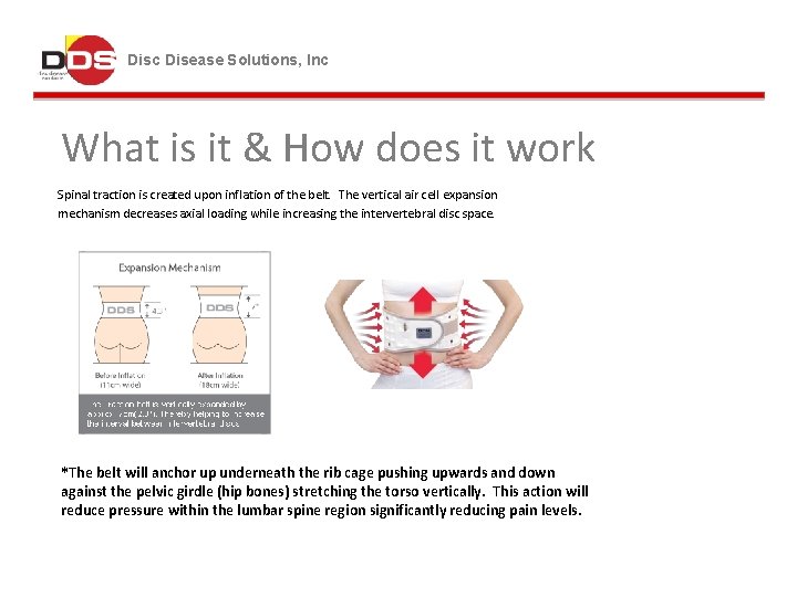Disc Disease Solutions, Inc What is it & How does it work Spinal traction