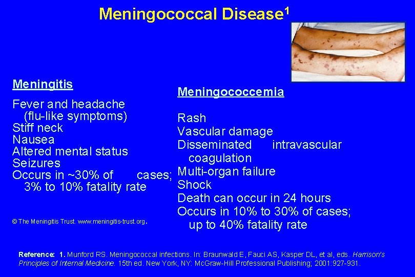 Meningococcal Disease 1 Meningitis Fever and headache (flu-like symptoms) Stiff neck Nausea Altered mental