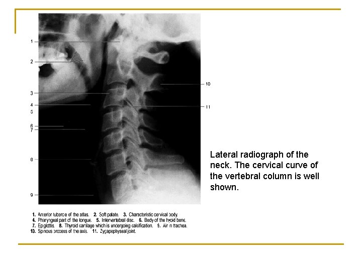 Lateral radiograph of the neck. The cervical curve of the vertebral column is well