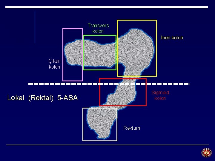 Transvers kolon İnen kolon Çıkan kolon Sigmoid kolon Lokal (Rektal) 5 -ASA Rektum 