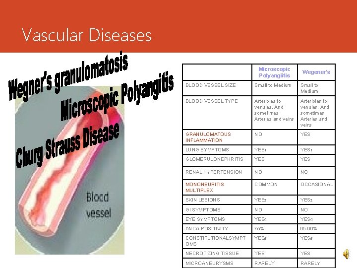 Vascular Diseases Microscopic Polyangiitis Wegener’s BLOOD VESSEL SIZE Small to Medium BLOOD VESSEL TYPE