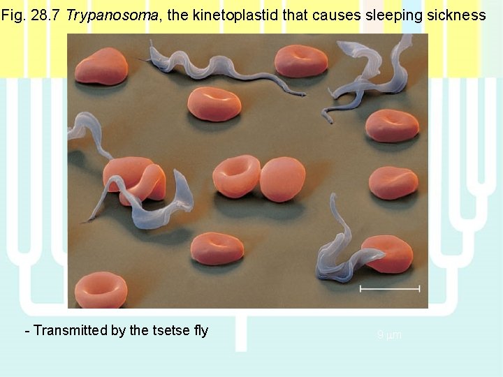 Fig. 28. 7 Trypanosoma, the kinetoplastid that causes sleeping sickness - Transmitted by the Fig. 28. 7 Trypanosoma, the kinetoplastid that causes sleeping sickness - Transmitted by the