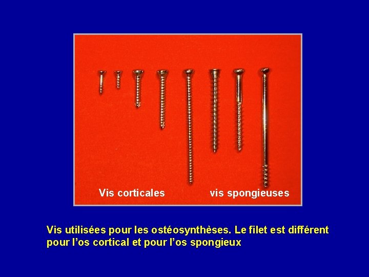 Vis corticales vis spongieuses Vis utilisées pour les ostéosynthèses. Le filet est différent pour