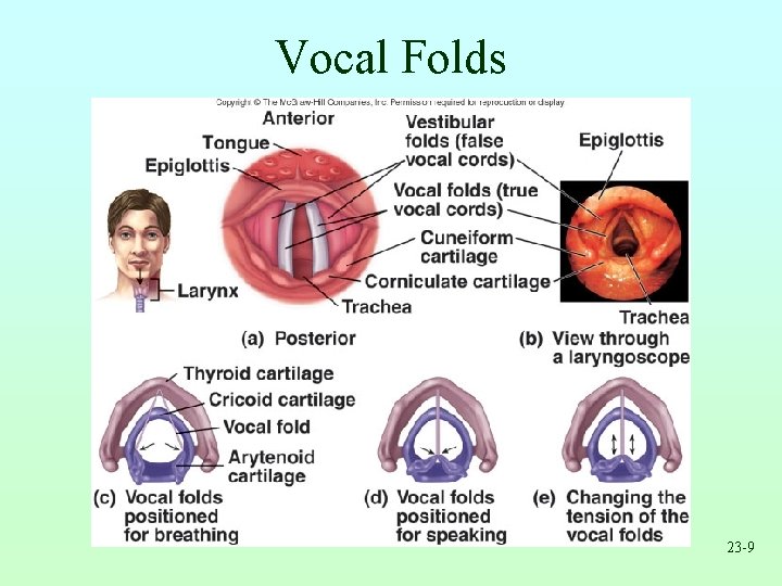 Vocal Folds 23 -9 