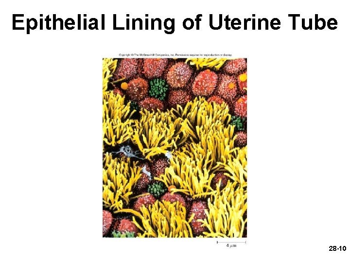 Epithelial Lining of Uterine Tube 28 -10 Epithelial Lining of Uterine Tube 28 -10
