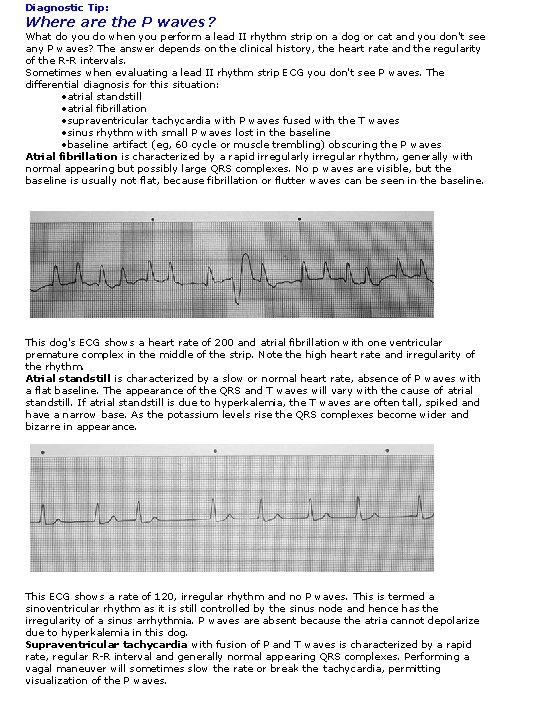 Diagnostic Tip: Where are the P waves? What do you do when you perform