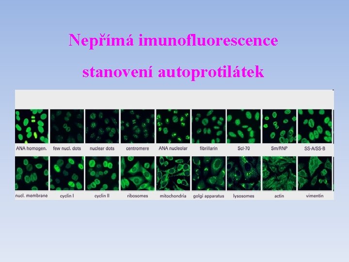 Nepřímá imunofluorescence stanovení autoprotilátek 