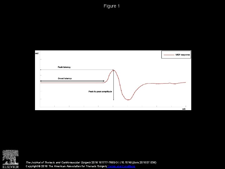 Figure 1 The Journal of Thoracic and Cardiovascular Surgery 2016 151777 -785 DOI: (10.