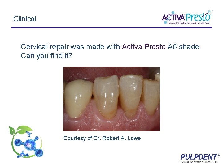 Clinical Cervical repair was made with Activa Presto A 6 shade. Can you find