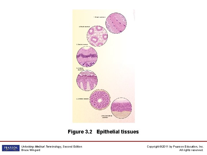 Figure 3. 2 Epithelial tissues Unlocking Medical Terminology, Second Edition Bruce Wingerd Copyright ©