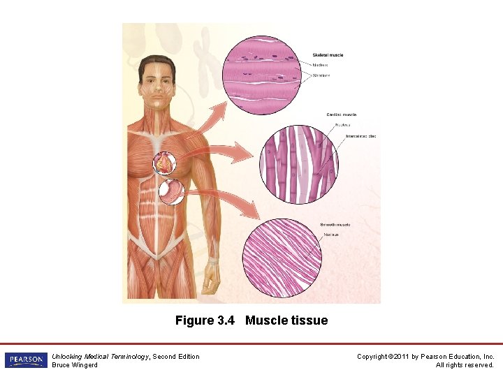 Figure 3. 4 Muscle tissue Unlocking Medical Terminology, Second Edition Bruce Wingerd Copyright ©