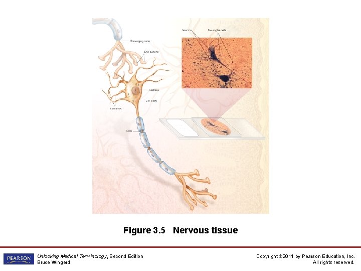 Figure 3. 5 Nervous tissue Unlocking Medical Terminology, Second Edition Bruce Wingerd Copyright ©
