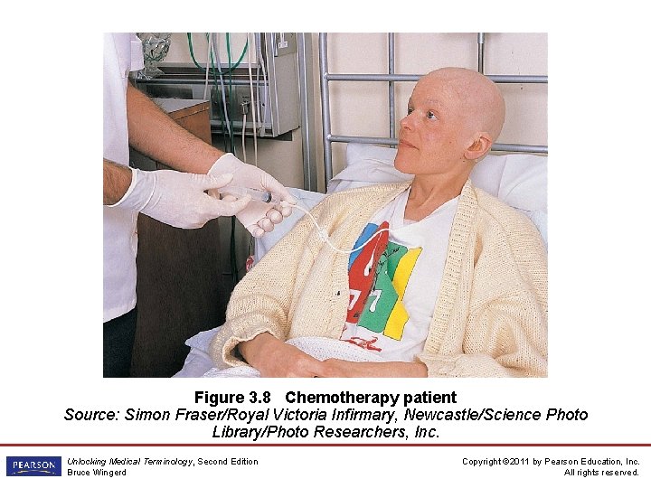 Figure 3. 8 Chemotherapy patient Source: Simon Fraser/Royal Victoria Infirmary, Newcastle/Science Photo Library/Photo Researchers,