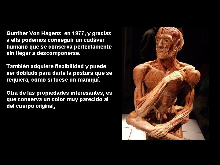 Gunther Von Hagens en 1977, y gracias a ella podemos conseguir un cadáver humano