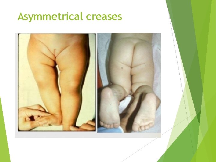 Asymmetrical creases 