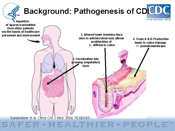 Clostridium difficile CDI Infections Toolkit Activity C ELC