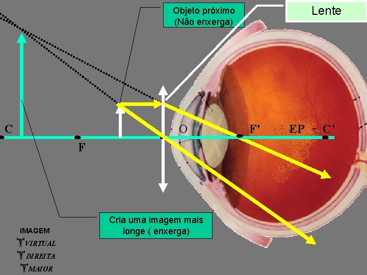 Lente Objeto próximo (Não enxerga) C O F IMAGEM VIRTUAL DIREITA MAIOR Cria uma