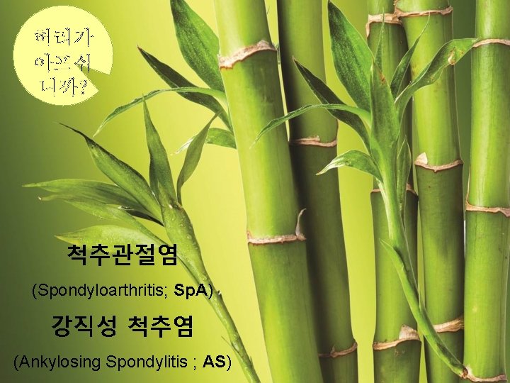 허리가 아프십 니까? 척추관절염 (Spondyloarthritis; Sp. A) 강직성 척추염 (Ankylosing Spondylitis ; AS) 