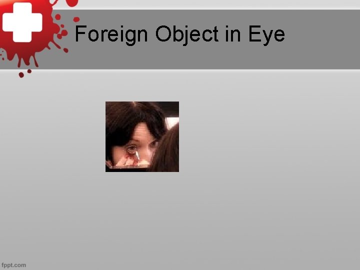 Foreign Object in Eye 