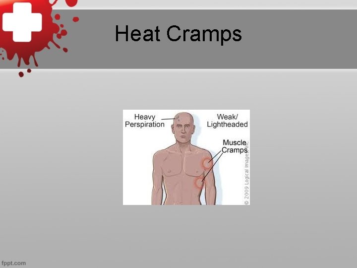 Heat Cramps 