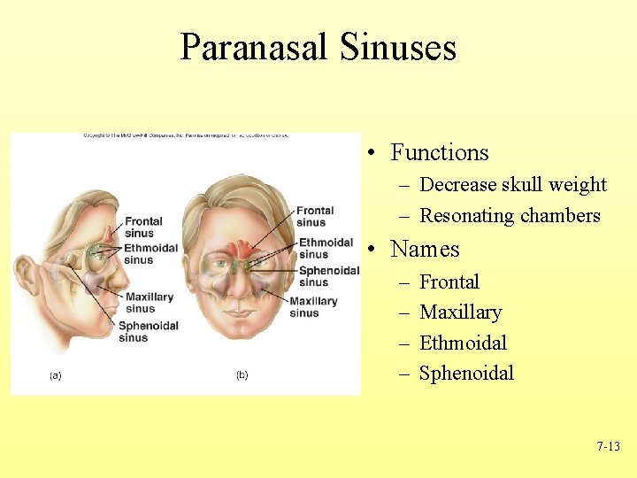 Paranasal Sinuses • Functions – Decrease skull weight – Resonating chambers • Names –