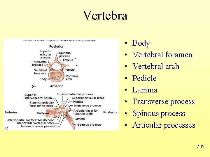Vertebra • • Body Vertebral foramen Vertebral arch Pedicle Lamina Transverse process Spinous process