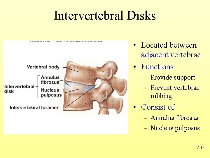 Intervertebral Disks • Located between adjacent vertebrae • Functions – Provide support – Prevent
