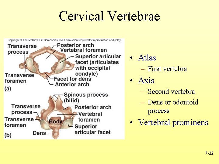 Cervical Vertebrae • Atlas – First vertebra • Axis – Second vertebra – Dens