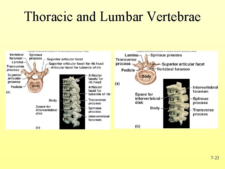 Thoracic and Lumbar Vertebrae 7 -23 