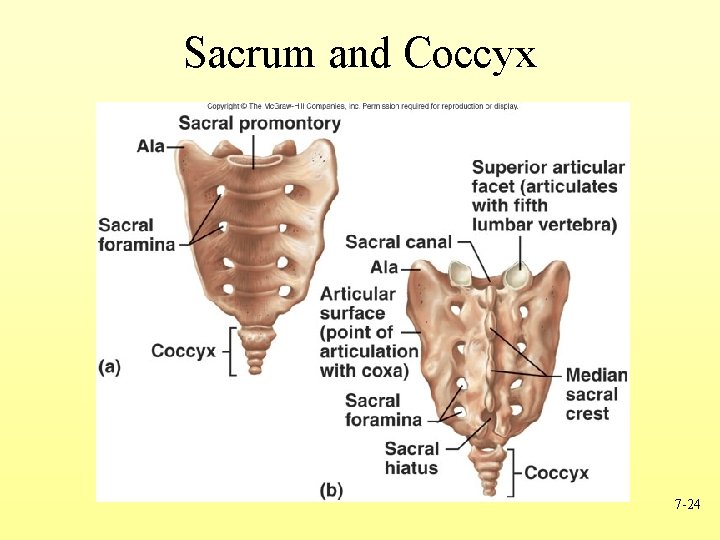 Sacrum and Coccyx 7 -24 