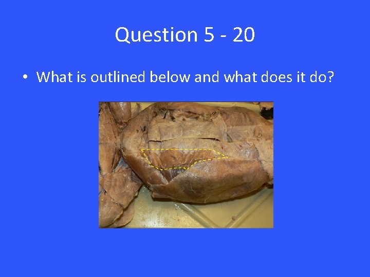 Question 5 - 20 • What is outlined below and what does it do?