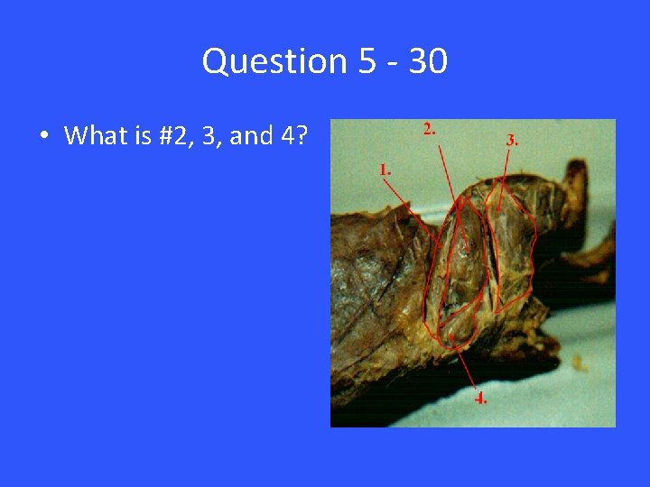 Question 5 - 30 • What is #2, 3, and 4? 