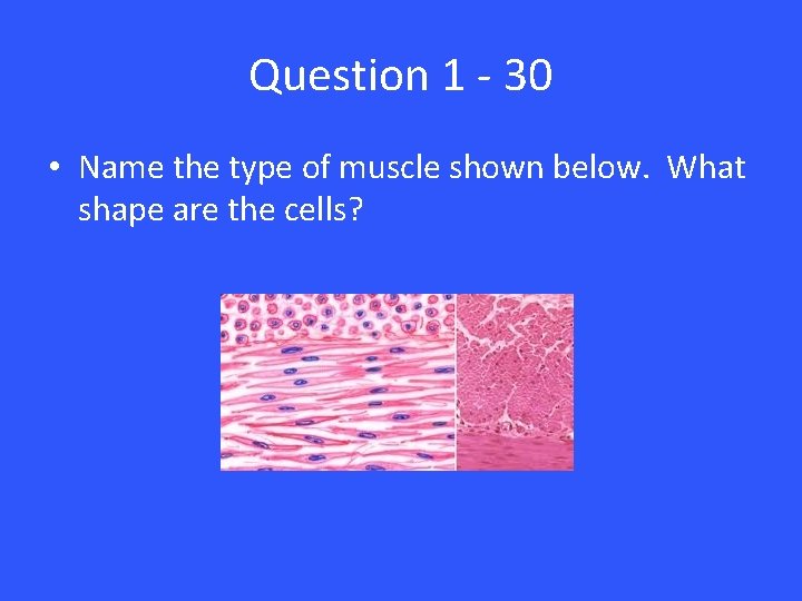 Question 1 - 30 • Name the type of muscle shown below. What shape