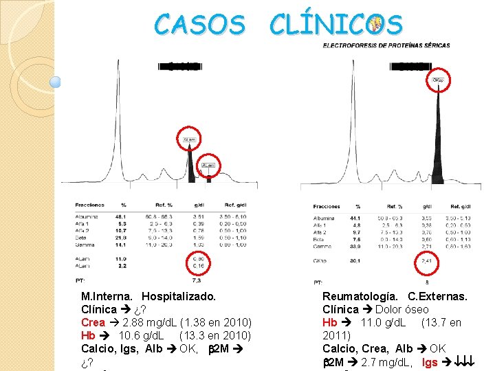 CASOS CLÍNICOS M. Interna. Hospitalizado. Clínica ¿? Crea 2. 88 mg/d. L (1. 38