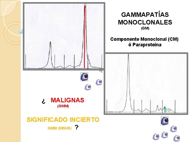 GAMMAPATÍAS MONOCLONALES (GM) Componente Monoclonal (CM) ó Paraproteína ¿ MALIGNAS (GMM) SIGNIFICADO INCIERTO GMSI