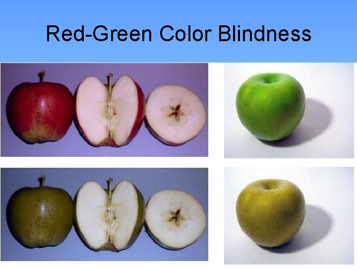 Red-Green Color Blindness 