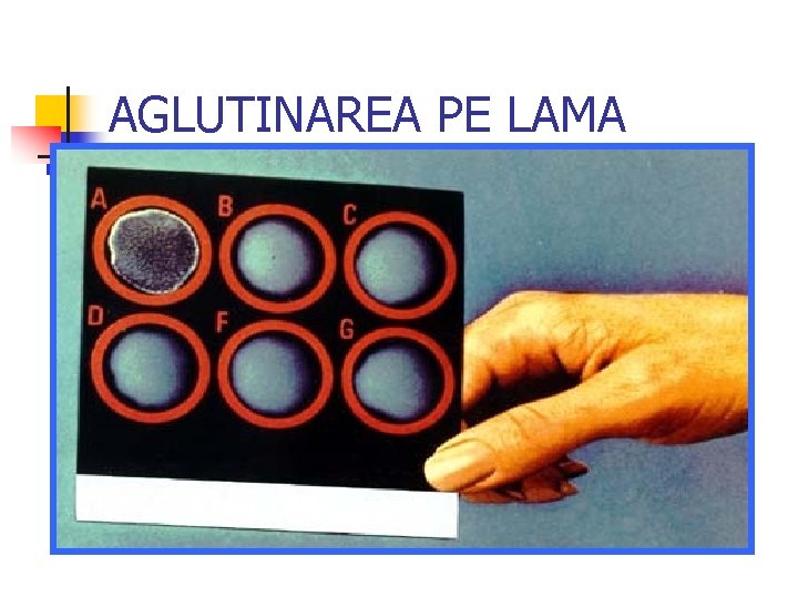 AGLUTINAREA PE LAMA 