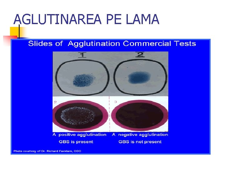 AGLUTINAREA PE LAMA 