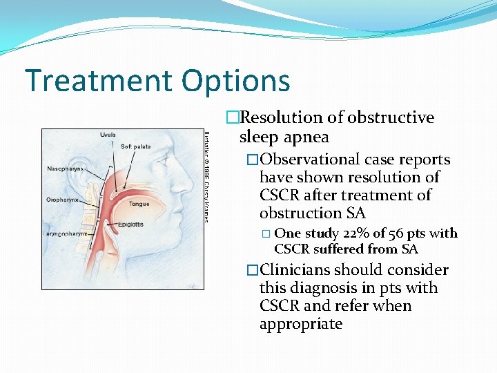 Treatment Options �Resolution of obstructive sleep apnea �Observational case reports have shown resolution of