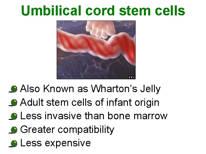 Umbilical cord stem cells • • • Also Known as Wharton’s Jelly Adult stem