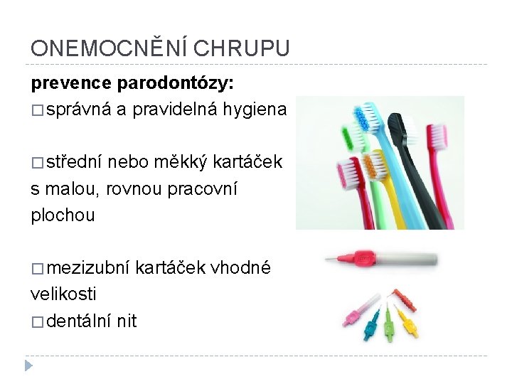 ONEMOCNĚNÍ CHRUPU prevence parodontózy: � správná a pravidelná hygiena � střední nebo měkký kartáček