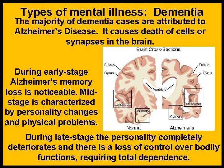 Types of mental illness: Dementia The majority of dementia cases are attributed to Alzheimer’s