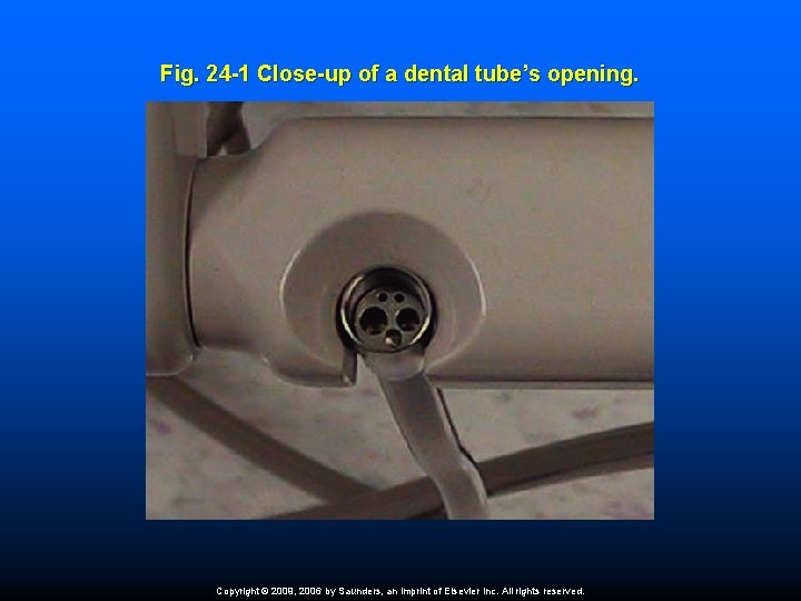 Fig. 24 -1 Close-up of a dental tube’s opening. Copyright © 2009, 2006 by