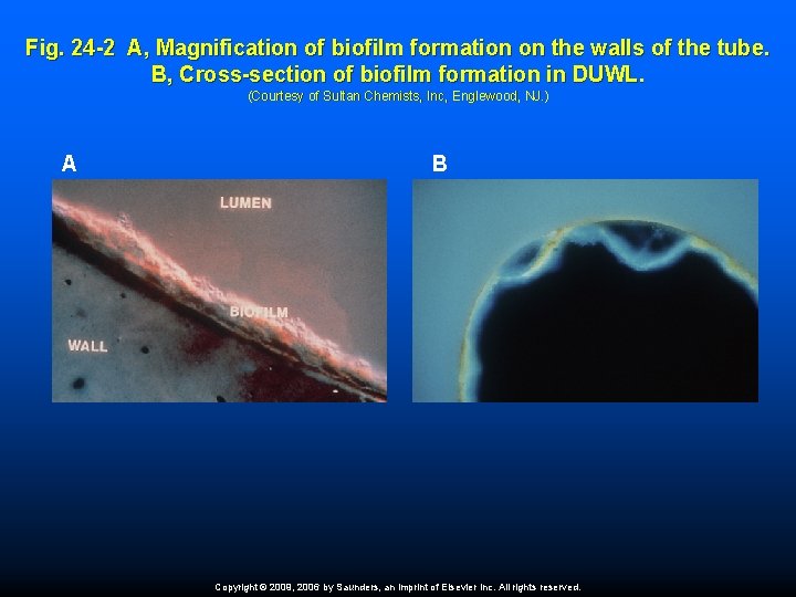 Fig. 24 -2 A, Magnification of biofilm formation on the walls of the tube.