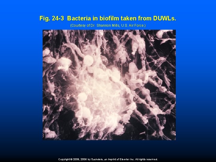 Fig. 24 -3 Bacteria in biofilm taken from DUWLs. (Courtesy of Dr. Shannon Mills,